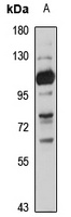 SLC28A3 Antibody