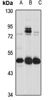 SLC30A6 Rabbit Polyclonal Antibody