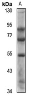 SLC5A12 Rabbit Polyclonal Antibody