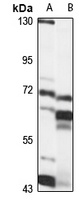 SLC5A9 Rabbit Polyclonal Antibody