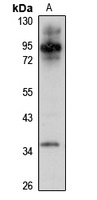 Dopamine Transporter Rabbit Polyclonal Antibody