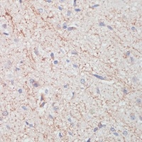 Dopamine Transporter Rabbit Polyclonal Antibody