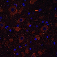 Dopamine Transporter Rabbit Polyclonal Antibody