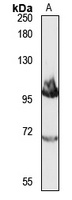 NCX2 Rabbit Polyclonal Antibody