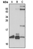 SLIRP Rabbit Polyclonal Antibody