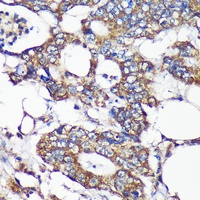 SLIRP Rabbit Polyclonal Antibody