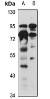 SLITRK4 Rabbit Polyclonal Antibody