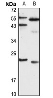 SNAP23 Rabbit Polyclonal Antibody