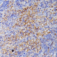 SNAP23 Rabbit Polyclonal Antibody