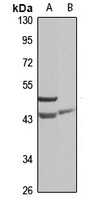 SNX7 Rabbit Polyclonal Antibody