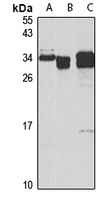 SOD3 Rabbit Polyclonal Antibody
