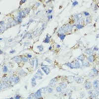 SOD3 Rabbit Polyclonal Antibody