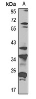 SPEM1 Rabbit Polyclonal Antibody