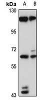 SRPK2 Rabbit Polyclonal Antibody