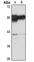 SRSF6 Rabbit Polyclonal Antibody