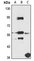 SS18L1 Antibody