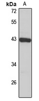 ST8SIA1 Rabbit Polyclonal Antibody