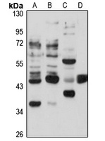 STAC Rabbit Polyclonal Antibody