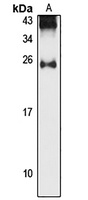 StARD5 Rabbit Polyclonal Antibody