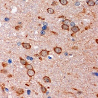 Stim2 Rabbit Polyclonal Antibody