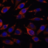 Stim2 Rabbit Polyclonal Antibody