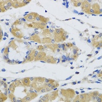 STK4 Rabbit Polyclonal Antibody