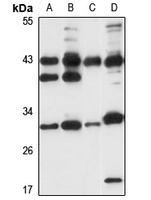 SUGT1 Rabbit Polyclonal Antibody
