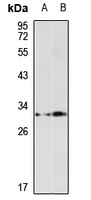 SULT1A2 Rabbit Polyclonal Antibody