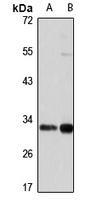 SUMF2 Rabbit Polyclonal Antibody