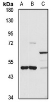 SUV420H2 Rabbit Polyclonal Antibody