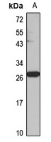 Synaptogyrin-1 Rabbit Polyclonal Antibody