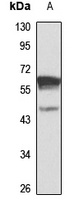 Synaptotagmin-1 Rabbit Polyclonal Antibody