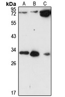 CCDC44 Rabbit Polyclonal Antibody
