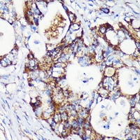 CCDC44 Rabbit Polyclonal Antibody