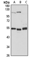 TADA3L Antibody
