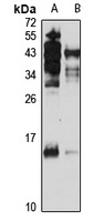 TAF12 Rabbit Polyclonal Antibody