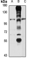 GPR70 Rabbit Polyclonal Antibody
