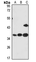 CKAP1 Rabbit Polyclonal Antibody