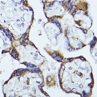 CKAP1 Rabbit Polyclonal Antibody