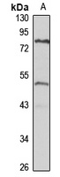 TBRG1 Rabbit Polyclonal Antibody