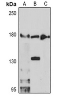 TET3 Rabbit Polyclonal Antibody