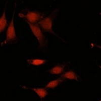 TET3 Rabbit Polyclonal Antibody