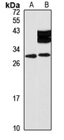 THAP3 Rabbit Polyclonal Antibody