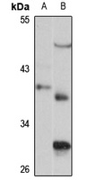 THOC3 Rabbit Polyclonal Antibody