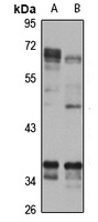 TRAM Rabbit Polyclonal Antibody