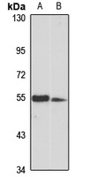 TINAGL1 Rabbit Polyclonal Antibody
