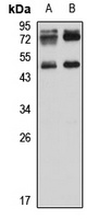 TIPIN Rabbit Polyclonal Antibody