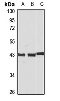 HOX11 Rabbit Polyclonal Antibody