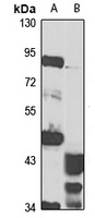 TM9SF3 Rabbit Polyclonal Antibody