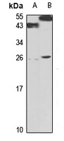 ST2L Rabbit Polyclonal Antibody